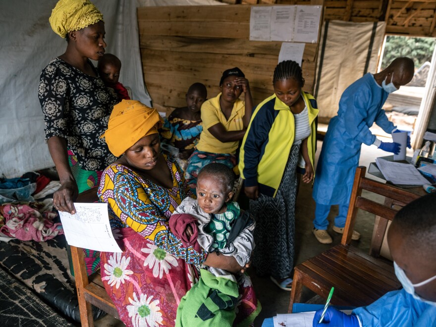 Congo Commences Mpox Vaccination Campaign Amid Outbreak