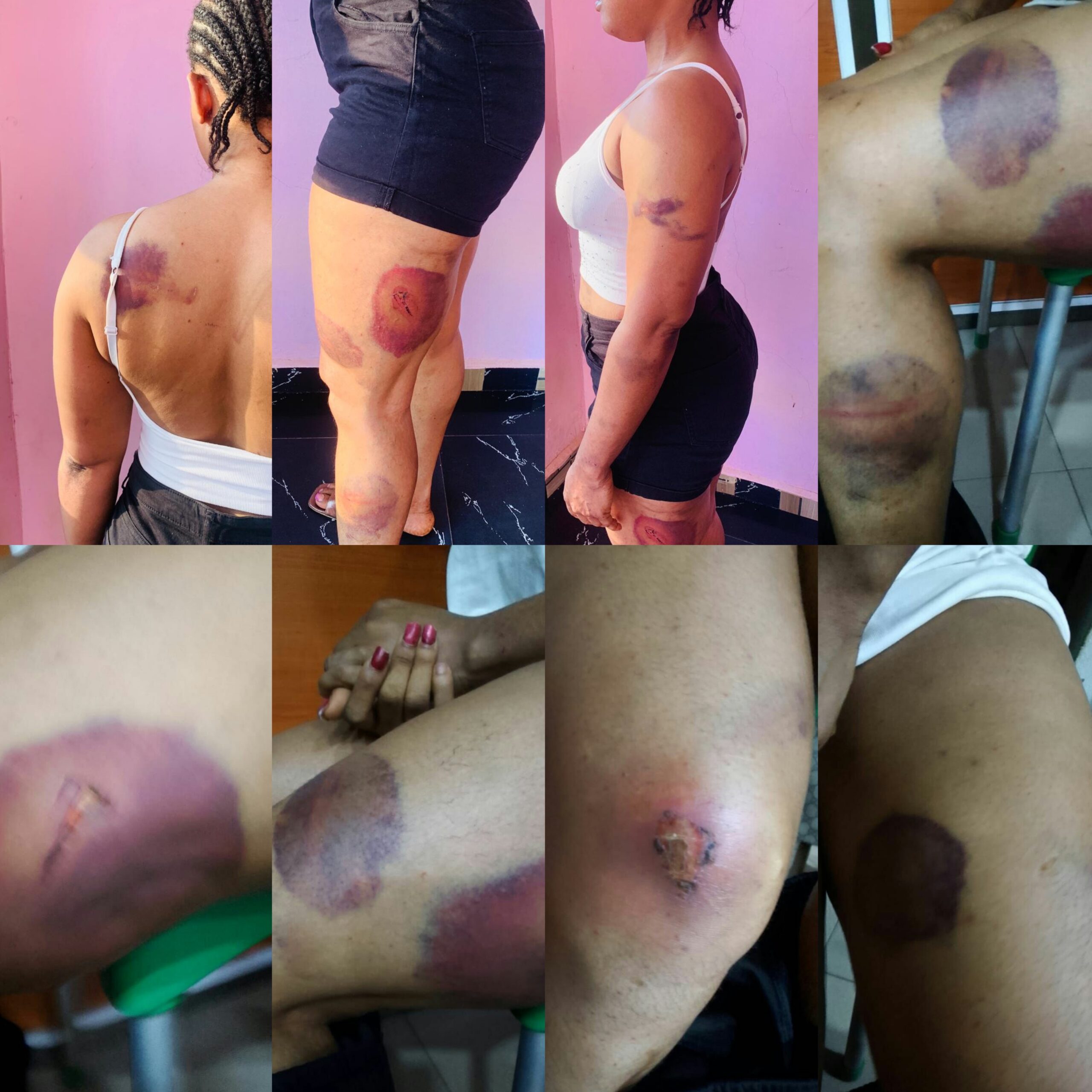 Woman alleges brutal arrest, days-long detention by Delta police, Nigeria, over condom possession