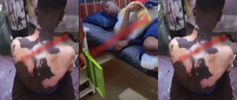 Student allegedly pours boiling water on lodge mate following sexual assault allegation, in Nigeria